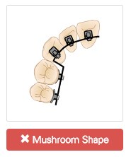 alias-features-straightwire-mushroom